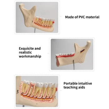 Трехкратная Модель Анатомии Нижних Зубов Человека Медицинское Учебное Пособие