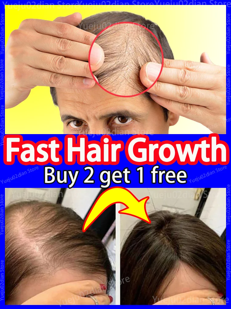 Сыворотка для здоровья густых волос для мужчин и женщин - 0