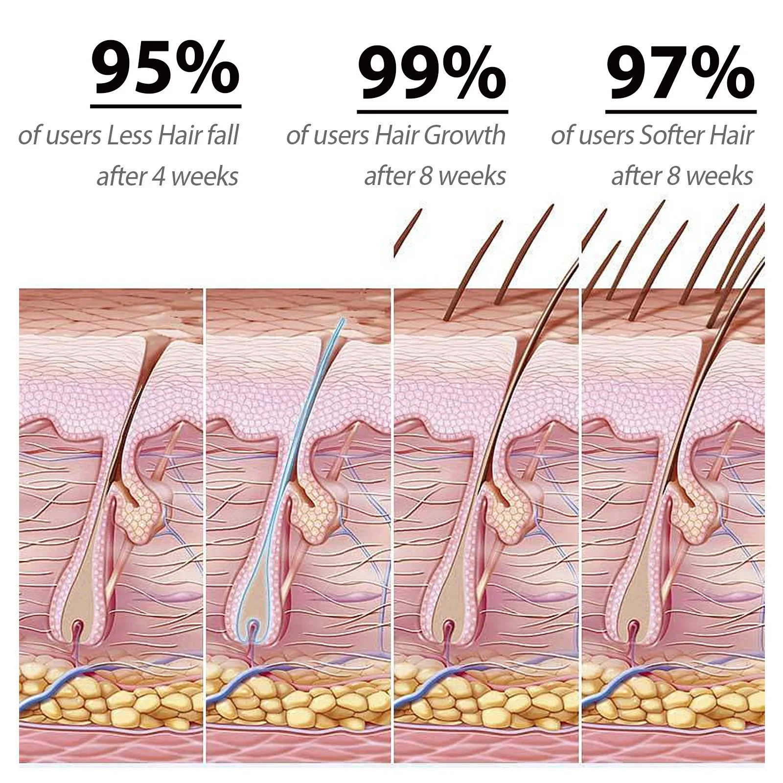 Шампунь для лечения выпадения волос, удаление перхоти, Восстановление волосяных фолликулов, Защита кожи головы От зуда, облысения, Шампунь для роста волос Сакура - 2