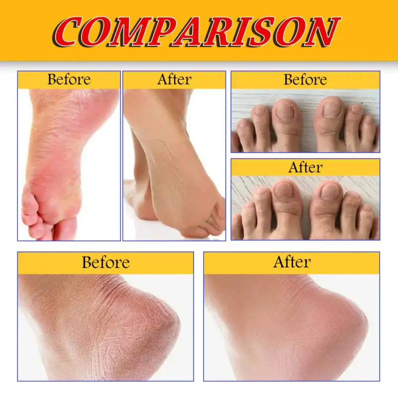 Увлажнение потрескавшихся ног Питательный Роскошный Увлажняющий Крем для ног Высокоэффективный Восстанавливающий Зудящие Ноги Увлажняющий Восстанавливающий - 4